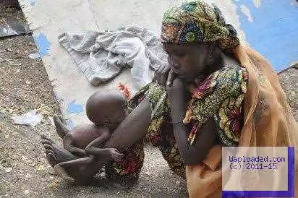 Photo Of A Malnourished Baby With Mother At Bama IDP Camp In Maiduguri
